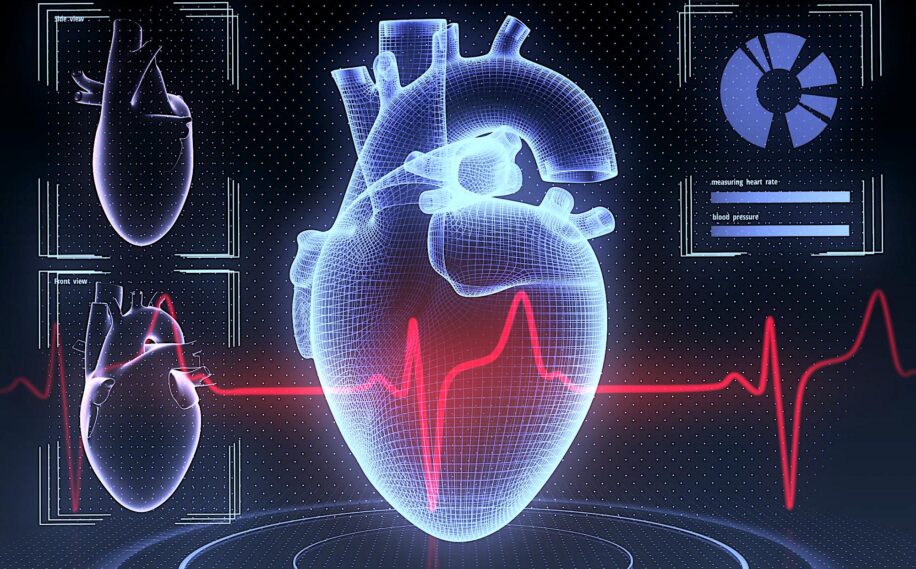 algorithme IA prédiction infarctus