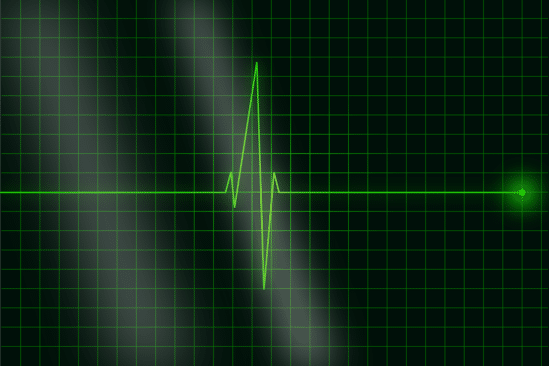 algorithme identifie battement coeur