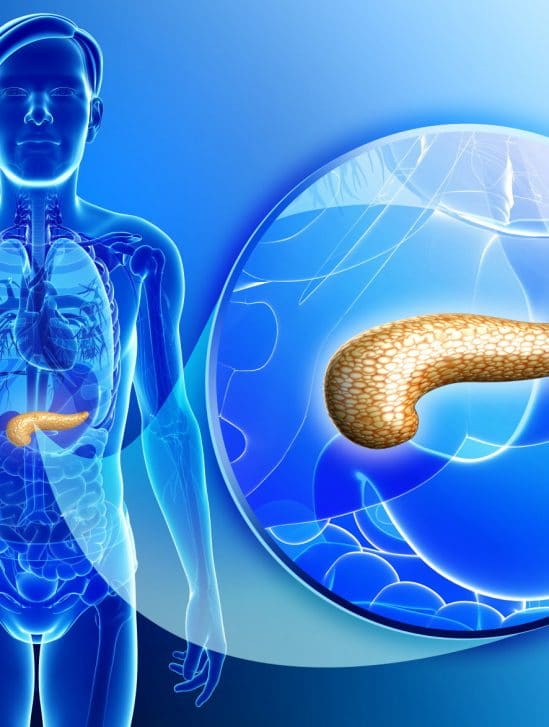cancer pancreas remede molecule ferroptose