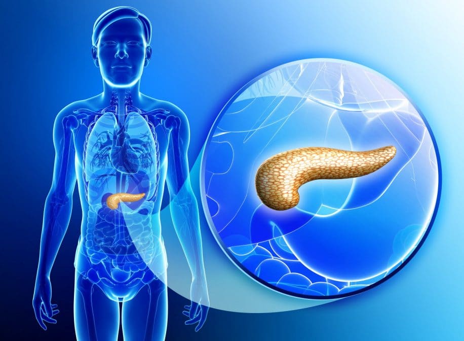 cancer pancreas remede molecule ferroptose