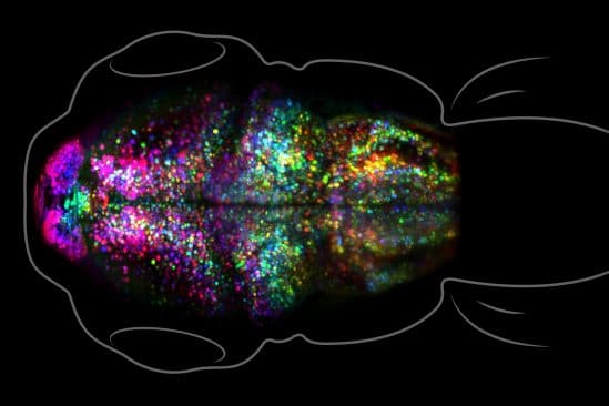 image cerveau creation souvenir temps reel innovation