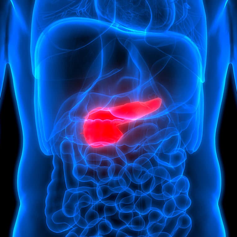 cancer pancreas intelligence artificielle detecter signes maladie
