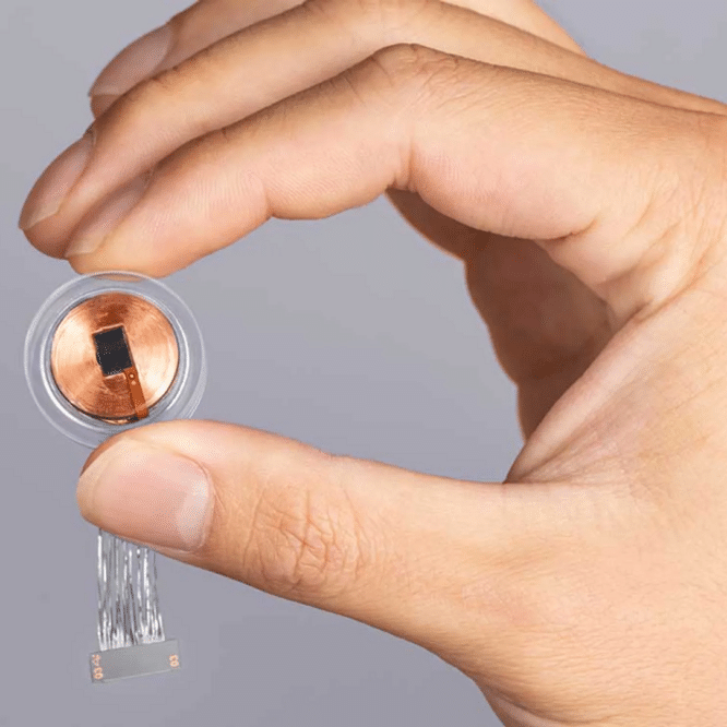 implant cerebral neuralink acouphenes 5 ans
