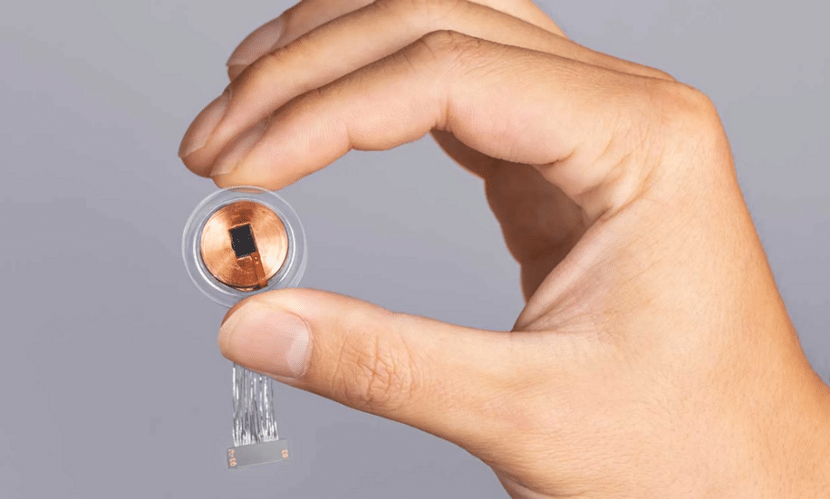 implant cerebral neuralink acouphenes 5 ans