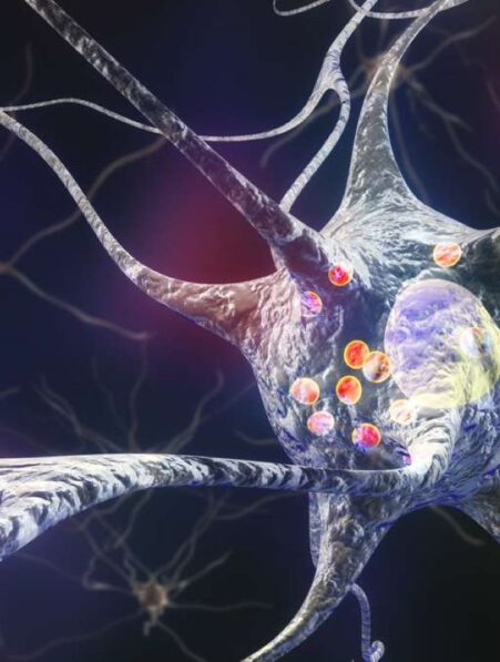 neurones specifiques mort cellulaire parkinson cible therapeutique couv