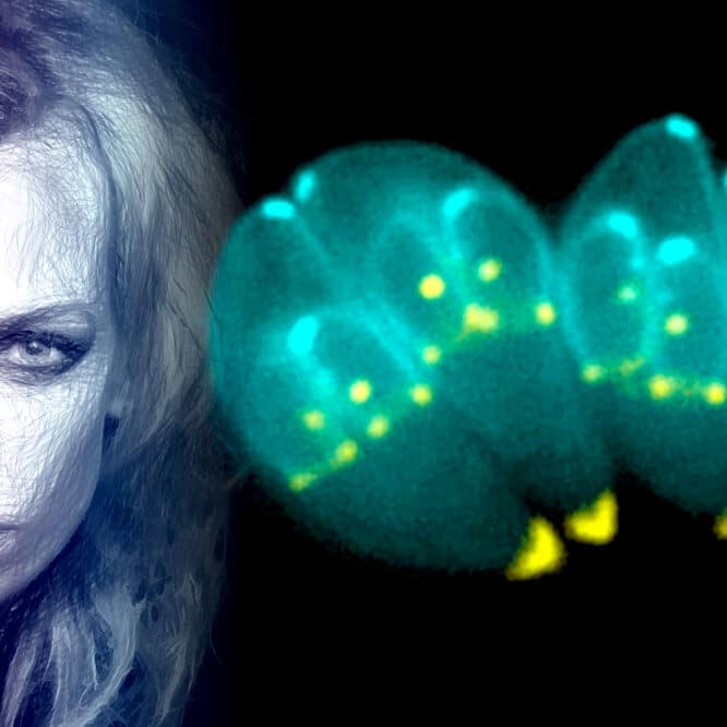 parasite toxoplasmose effets traits humains