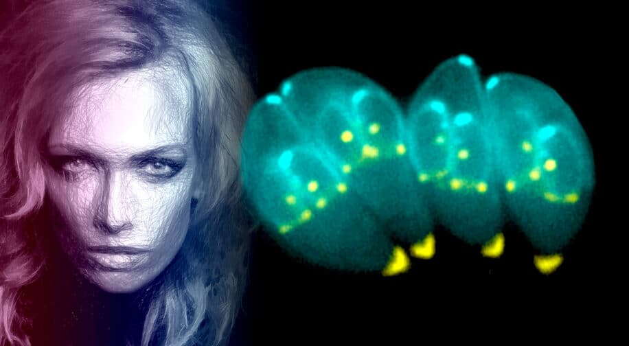 parasite toxoplasmose effets traits humains