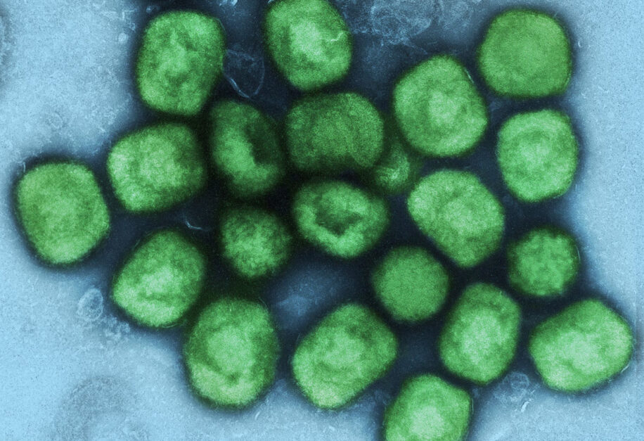 propagation virus variole singe