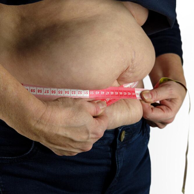 traitement obésité 24kg