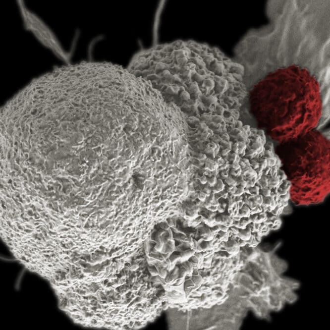 essai immunothérapie cancer rectum