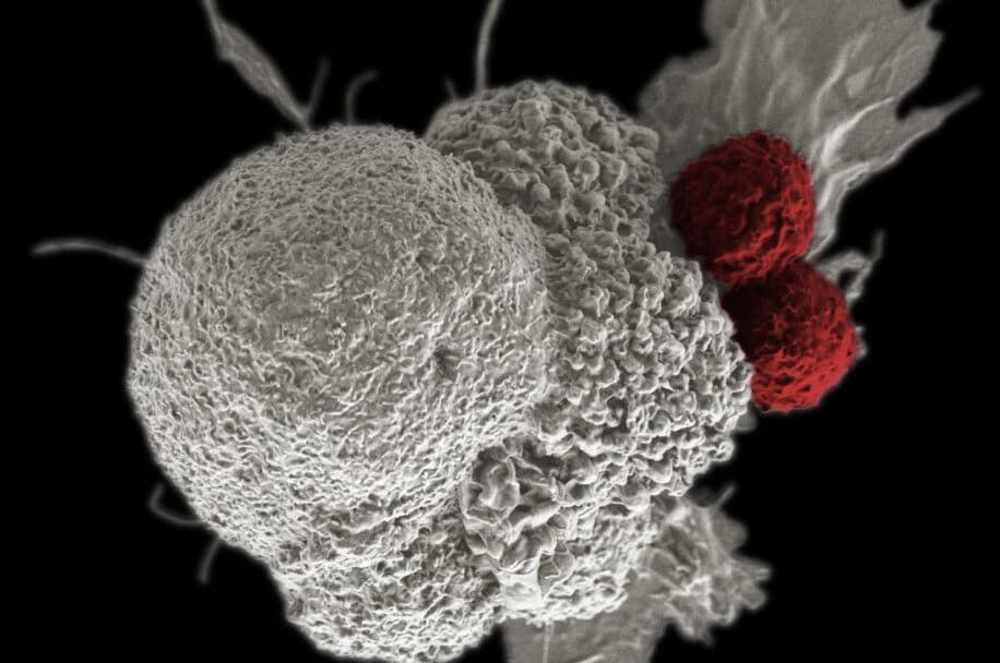 essai immunothérapie cancer rectum