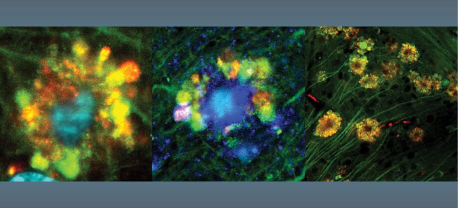 fleurs vénéneuses origine alzheimer