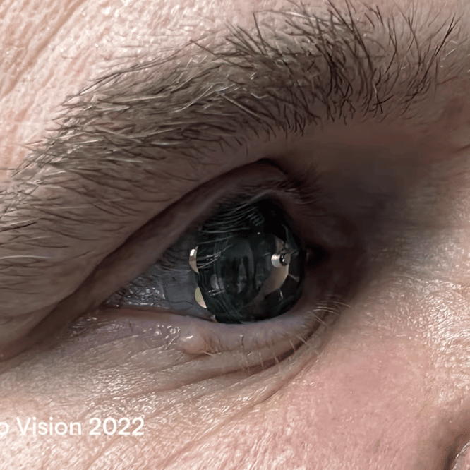 premieres lentilles réalité augmentée testées être humain