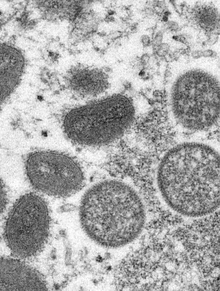 variole singe epidemie evolution acceleree virus