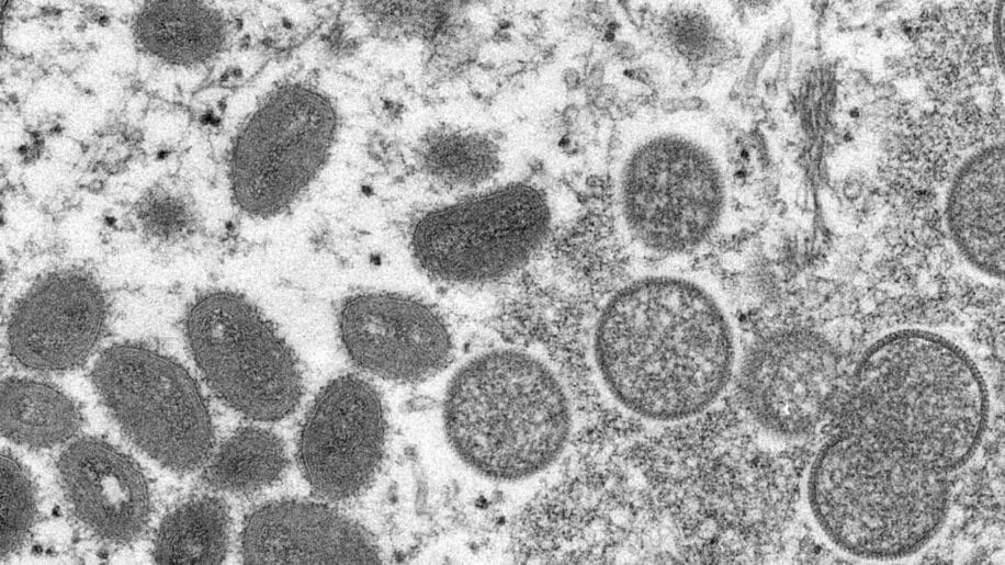 variole singe epidemie evolution acceleree virus
