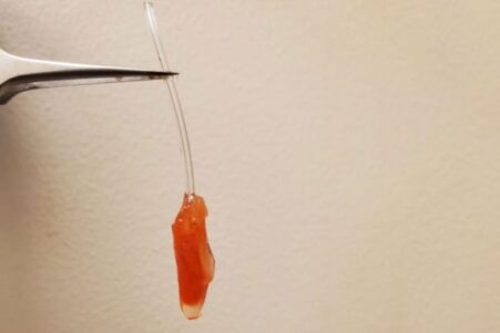ventricule fonctionnel gauche coeur bioartificiel couv