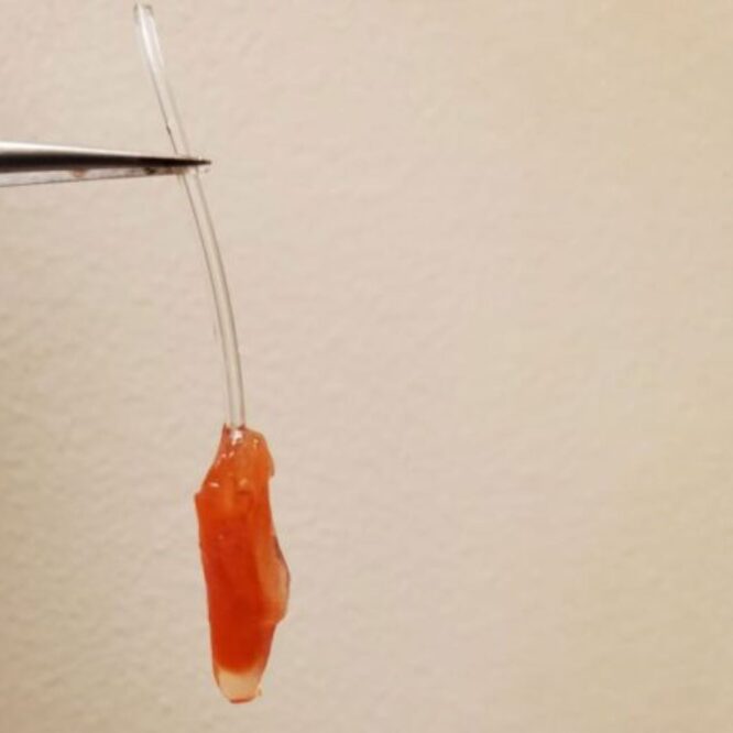 ventricule fonctionnel gauche coeur bioartificiel couv