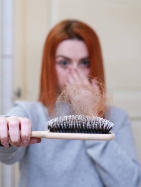 médicament chute cheveux alopécie