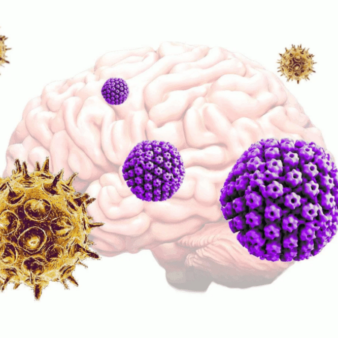 virus herpes varicelle zona declencheurs maladie alzheimer couv