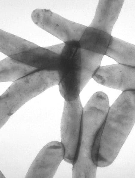 bactérie legionella pneumophila pneumonie Argentine