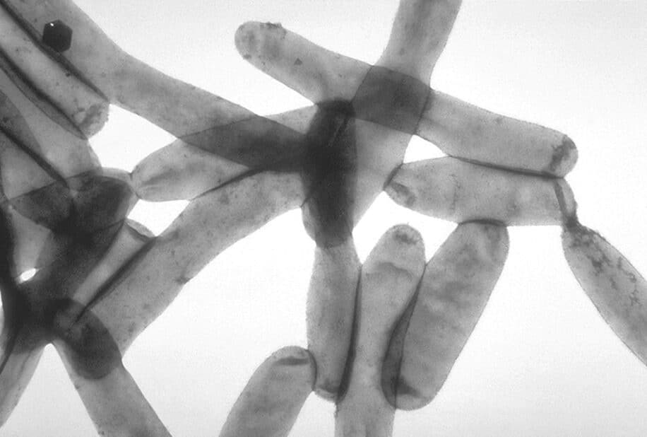 bactérie legionella pneumophila pneumonie Argentine