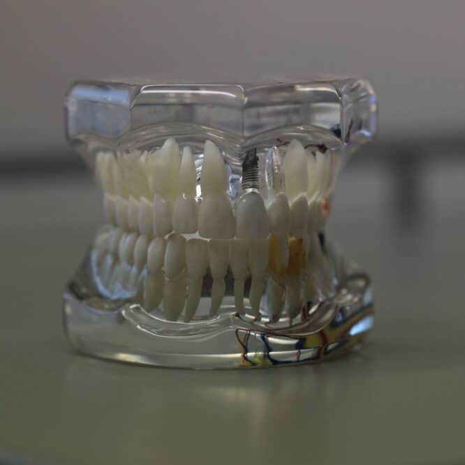 biorevetement email plus resistant