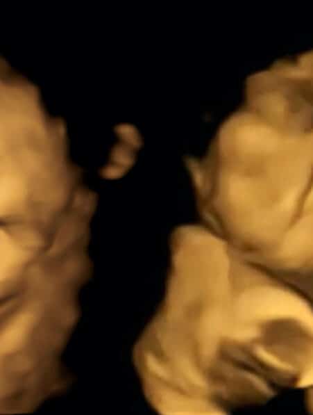 reactions foetus saveurs aliments