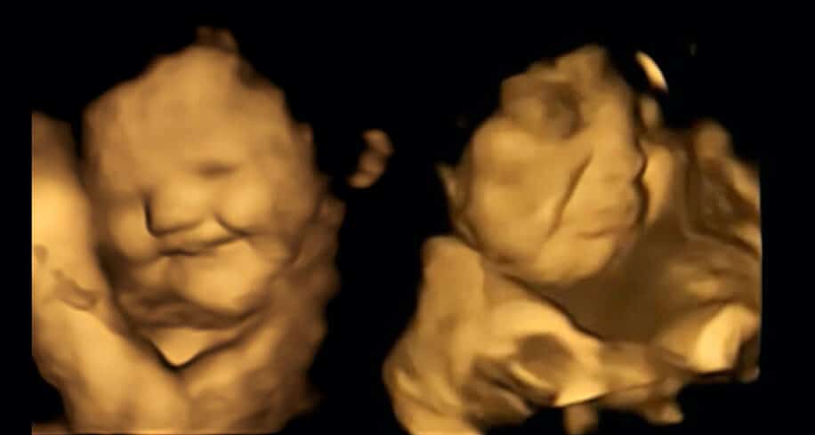 reactions foetus saveurs aliments