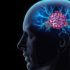 risque augmente alzheimer personnes agees apres covid 19 couv
