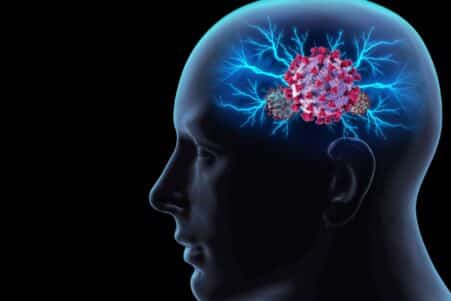 risque augmente alzheimer personnes agees apres covid 19 couv