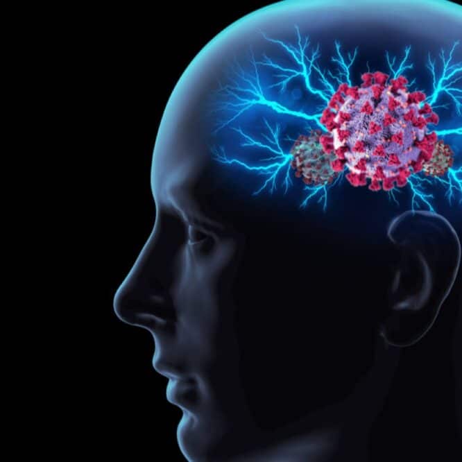 risque augmente alzheimer personnes agees apres covid 19 couv