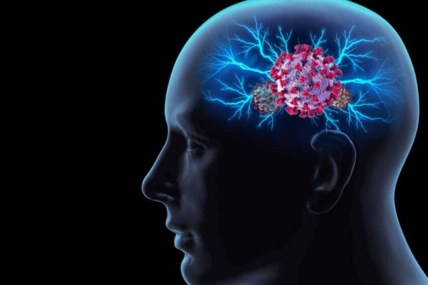 risque augmente alzheimer personnes agees apres covid 19 couv