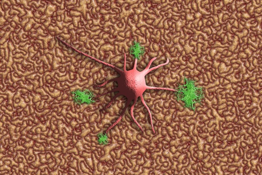 alzheimer diminution amyloides soluble