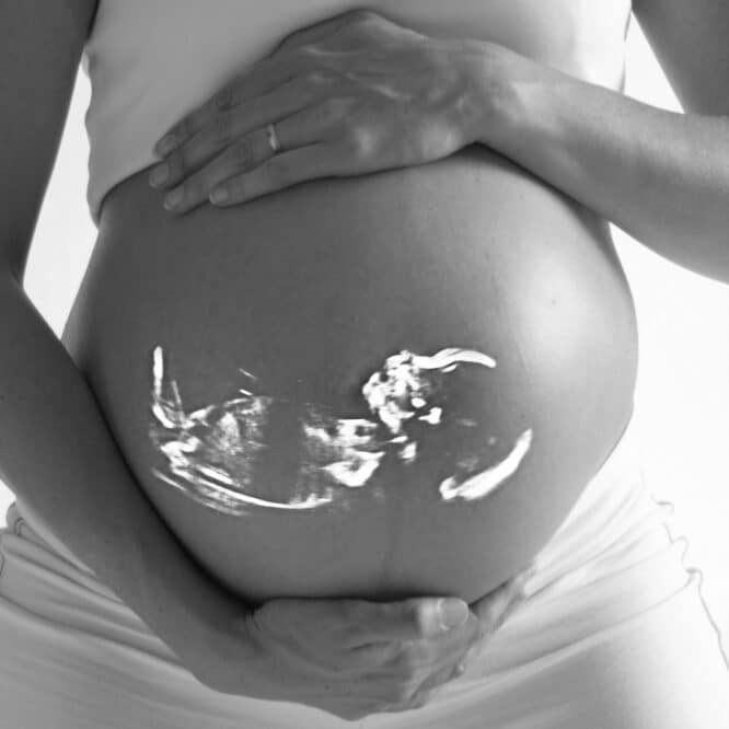 carbone noir foetus