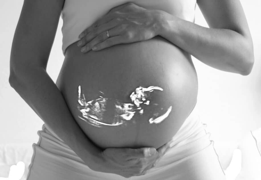 carbone noir foetus