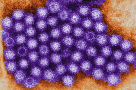 norovirus declencheur maladie crohn nouvelle therapie couv