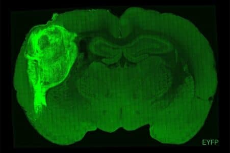 transplantation cortex humain cerveau rat maladie mentale couv