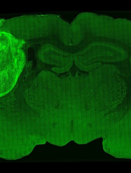 transplantation cortex humain cerveau rat maladie mentale couv