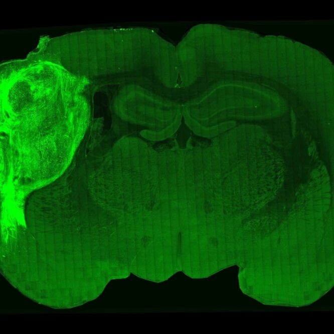 transplantation cortex humain cerveau rat maladie mentale couv