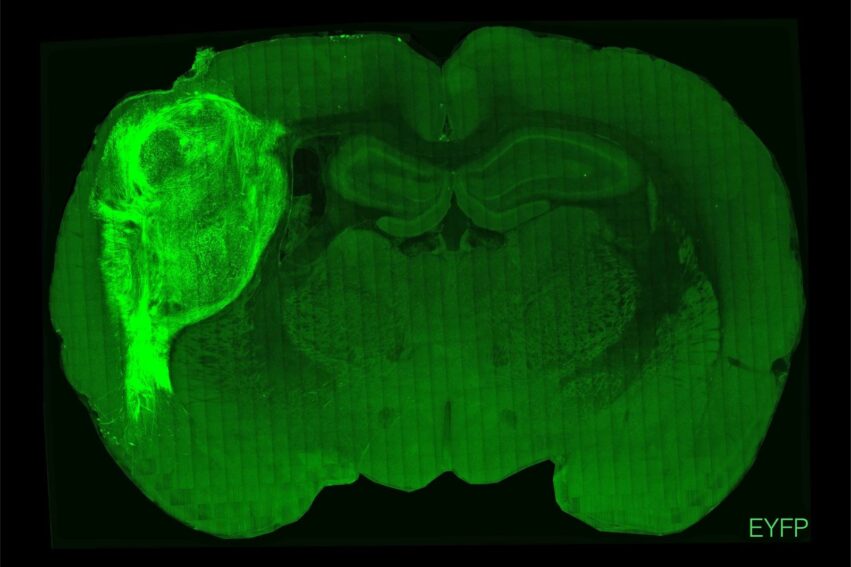 transplantation cortex humain cerveau rat maladie mentale couv