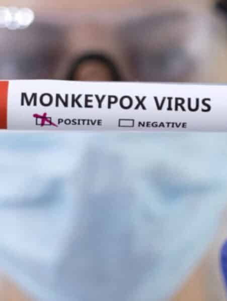 virus variole du singe République Démocratique du Congo