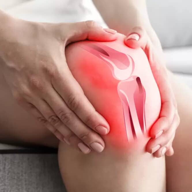 médicaments anti-inflammatoires arthrose synovite