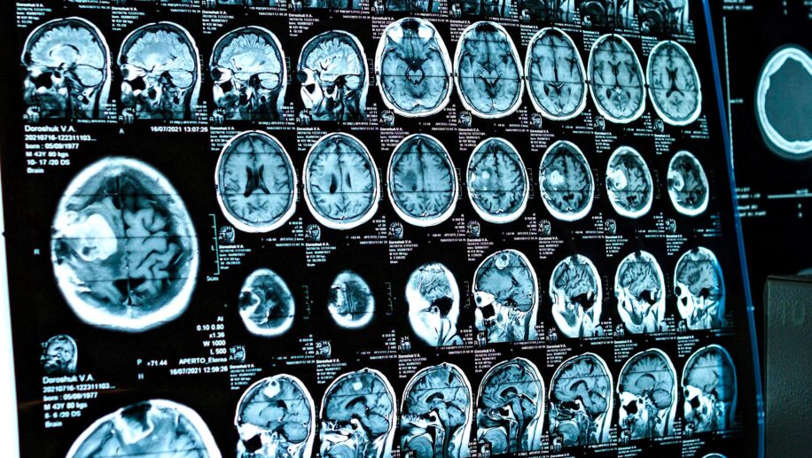 COVID impact cerveau adolescents