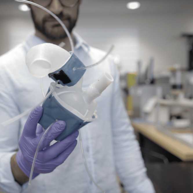 ingénieurs impriment coeurs 3D aider médecins traiter