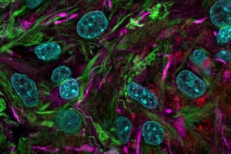 bio-ordinateurs organoïdes cerveau