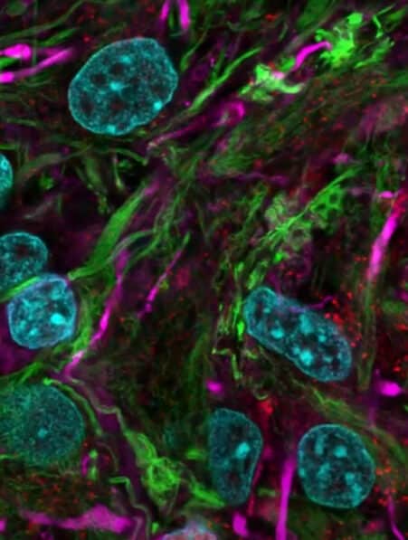 bio-ordinateurs organoïdes cerveau