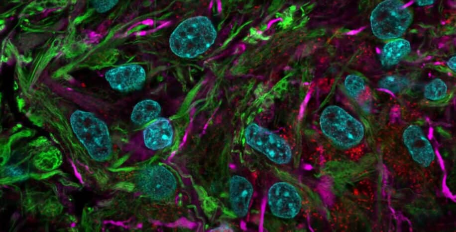 bio-ordinateurs organoïdes cerveau