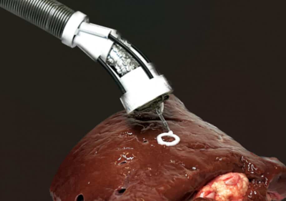 bio-impression 3D in vivo bras robotique
