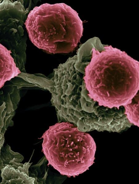 melanome proteine resistantes
