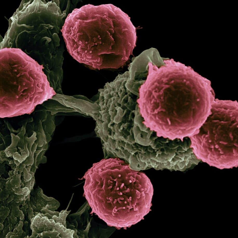 melanome proteine resistantes